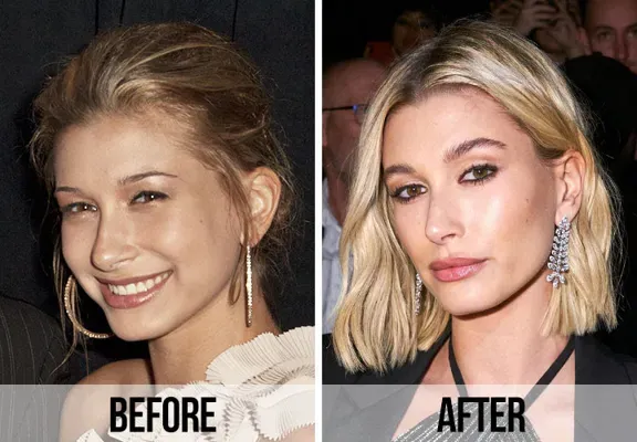 Hailey Bieber Transformation: Stunning Before and After Photos